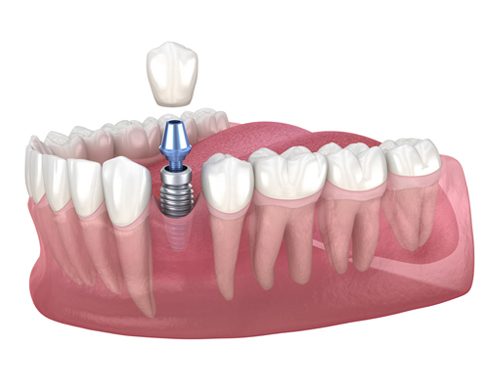 AdobeStock_366183707_500x380-500x380